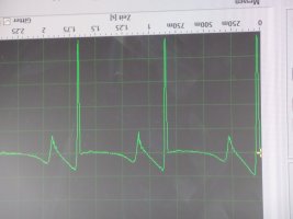 EKG 4.JPG