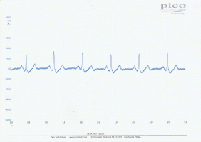 EKG von Biosignals.gif